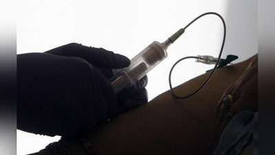 'Саратонни эрта аниқловчи янги тахшис-тест яратилди'ning rasmi