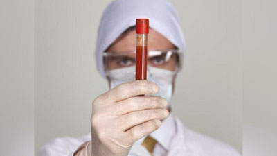 'Yangi koronavirus uchun qaysi qon guruhi eng xavfli ekani ma`lum qilindi'ning rasmi