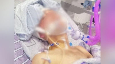 '"Besh kundandan beri komada yotgan" san`at instituti talabasi haqida ma`lumot berildi'ning rasmi