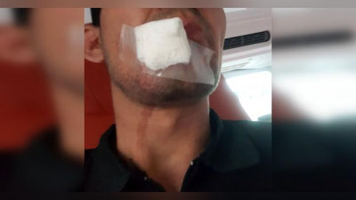 'Toshkent viloyatida bemor tez yordam shifokorining jag`iga musht tushirdi'ning rasmi
