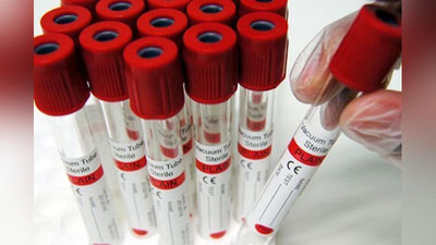 '​SSV:  Qrim-Kongo gemorragik isitmasi bilan kasallanib tuzalganlarning qon plazmasi banki yaratiladi'ning rasmi