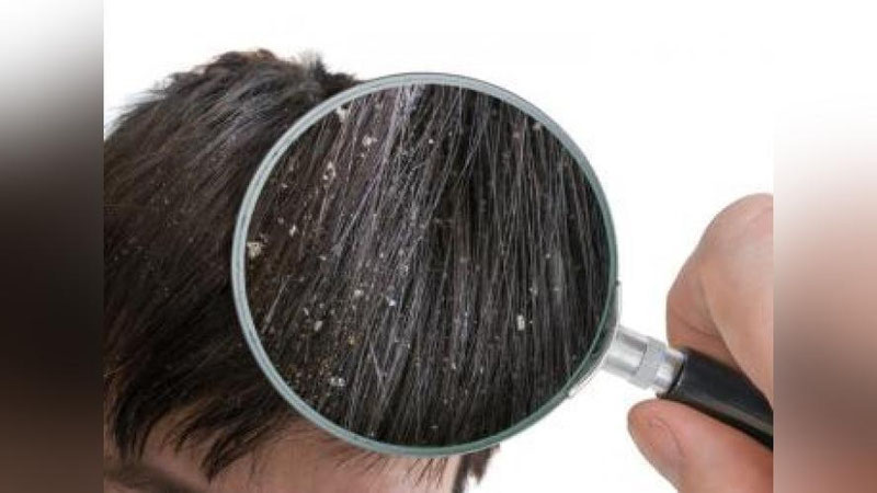 'ҚАЗҒОҚДАН ХАЛОС БЎЛИНГ!'ning rasmi