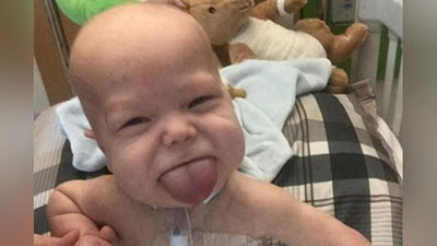 'Chaqaloqning tili qisqartirildi'ning rasmi