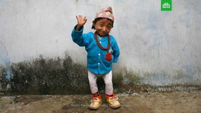 Изрображение 'Скончался самый маленький человек в мире'