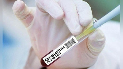 'Ayni soatda 124 fuqaroda koronavirus aniqlandi, Toshkentda ikki bemor vafot etdi'ning rasmi
