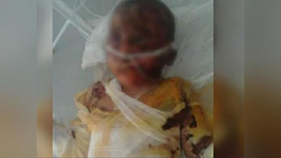 'Namangandagi bog`chada 6 yoshli bola issiq suvdan kuyib vafot etdi'ning rasmi