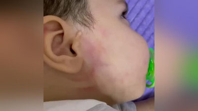 'Samarqandda 1 yoshli bola kaltaklandimi? Viloyat IIB izoh berdi'ning rasmi