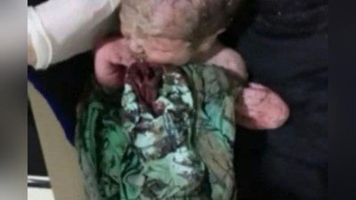 Изрображение 'Врачи в Нукусе спасли жизнь брошенного на холоде новорожденного (видео)'
