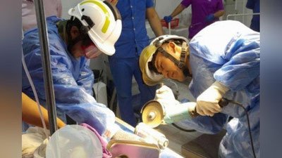 'Қашқадарёда қўли гўшт майдалагичга кириб кетган боланинг аҳволи ҳақида қўшимча маълумот берилди'ning rasmi