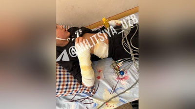 Изрображение 'В Гулистане второклассника ударило током из транформатора'