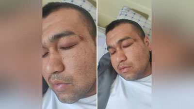 'Farg`onada o`qituvchi o`quvchining qarindoshlari tomonidan kaltaklandi (video)'ning rasmi