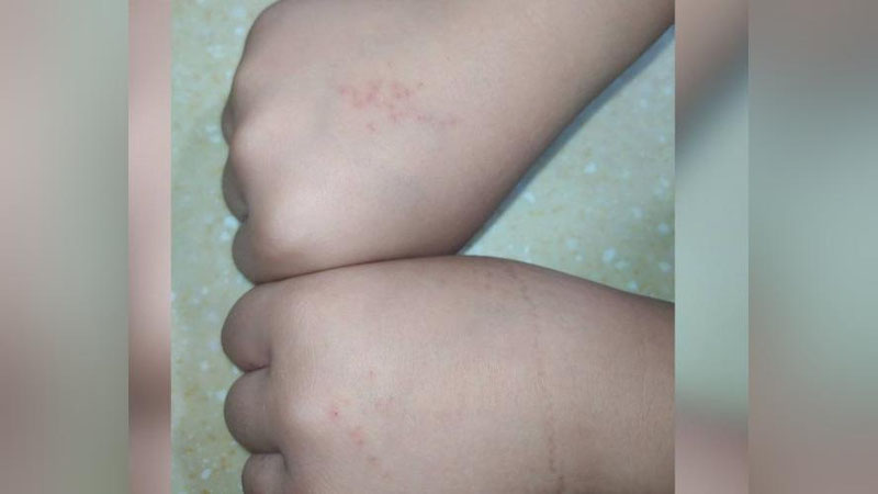 'Toshkentda o`qituvchi xato qilgan o`quvchilarini jazolashda shafqatsizlik qildi'ning rasmi