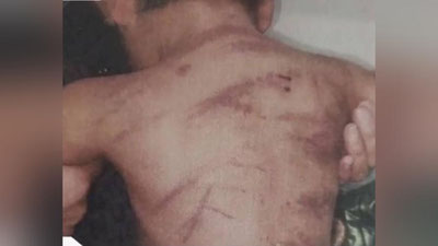 'Qashqadaryoda bolasini kaltaklagan ona 5 yilga qamaldi'ning rasmi