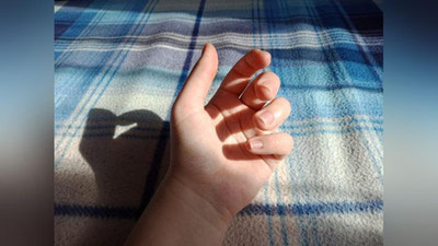 Изрображение 'Названы три признака «омикрон»-штамма на коже'