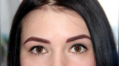 Изрображение 'Как удалить последствия татуажа?'