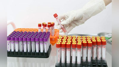 'SSV: Vazirlik tizimida pandemiya davrida 10 mlnga yaqin PZR test o`tkazildi'ning rasmi