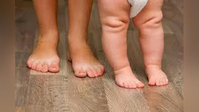 'Кичкина оёқчанинг катта ташвишлари​ ёки болалардаги ортопедик муаммолар ҳақида'ning rasmi