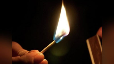 '​Ehtiyotsizlik oqibatida 9 yoshli bola avtomashina salonida yonib ketdi'ning rasmi