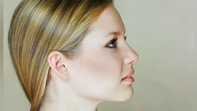 Изрображение 'РИНОПЛАСТИКА: СЕКРЕТ КРАСИВОГО ПРОФИЛЯ'