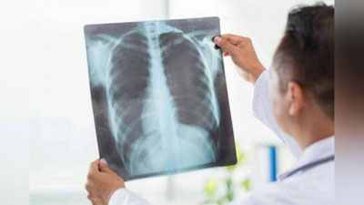 'Bolalarda pnevmoniya belgilari va kasallikning qanday kechishi haqida ma`lum qilindi'ning rasmi