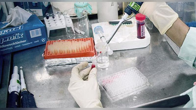 'Саратон ўсмасини даволашнинг янги услуби топилди'ning rasmi