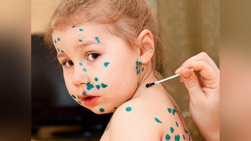 'Фарзандингиз сувчечак билан оғриса...'ning rasmi