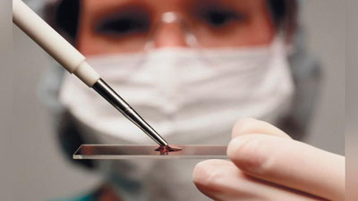 'Qon quyuqlashishi qanchalik xavfli?'ning rasmi