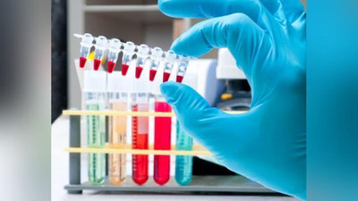 'O`zbekistonda 1 fevraldan sportchilardan doping-test olinadi'ning rasmi
