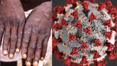 'ЖССТ маймунчечакка қарши кураш учун 135 млн доллар сўради'ning rasmi