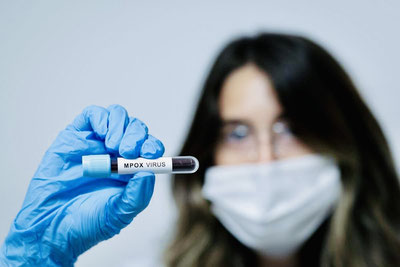 'Иордания подшоҳлигида маймунчечак бўйича биринчи ҳолат аниқланди'ning rasmi