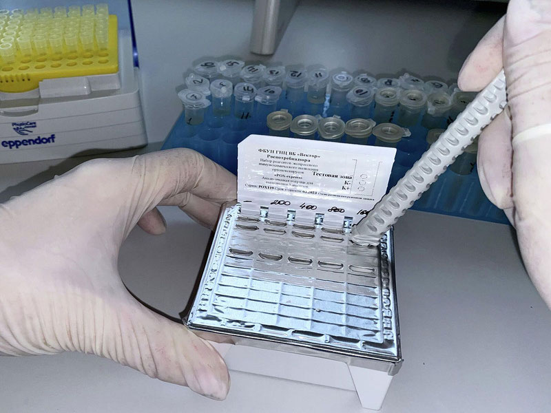 Image of 'The first test to detect the monkeypox virus has been approved.'