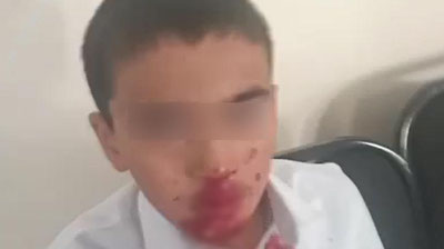 Image of 'In Kashkadarya, a teacher beat a student.'