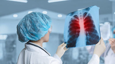 Image of 'Last year, 10.8 million people worldwide were diagnosed with tuberculosis.'