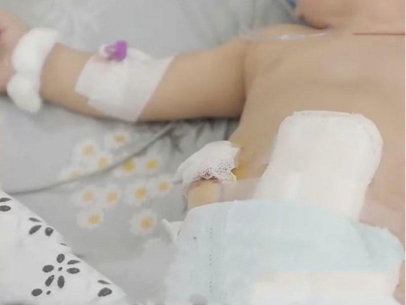 Image of 'Due to "fast-food," a 10-month-old baby's intestines were removed in Tashkent.'