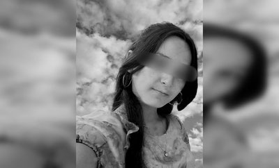 Изрображение 'В Самарканде 16-летняя девушка скончалась во время операции на нос'