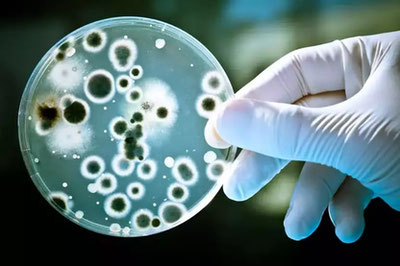 Image of 'Cholera-causing bacteria found on Turkey's shores'
