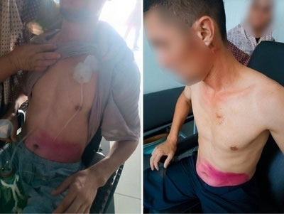 'Namanganda fuqaroni qiynoqqa solgan amaldor ishdan olindi'ning rasmi