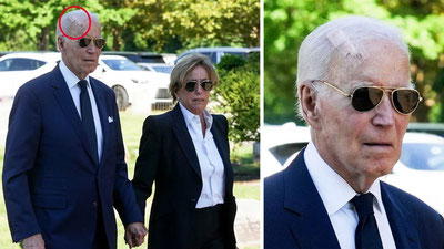 Image of 'A cancerous growth was removed from Biden.'