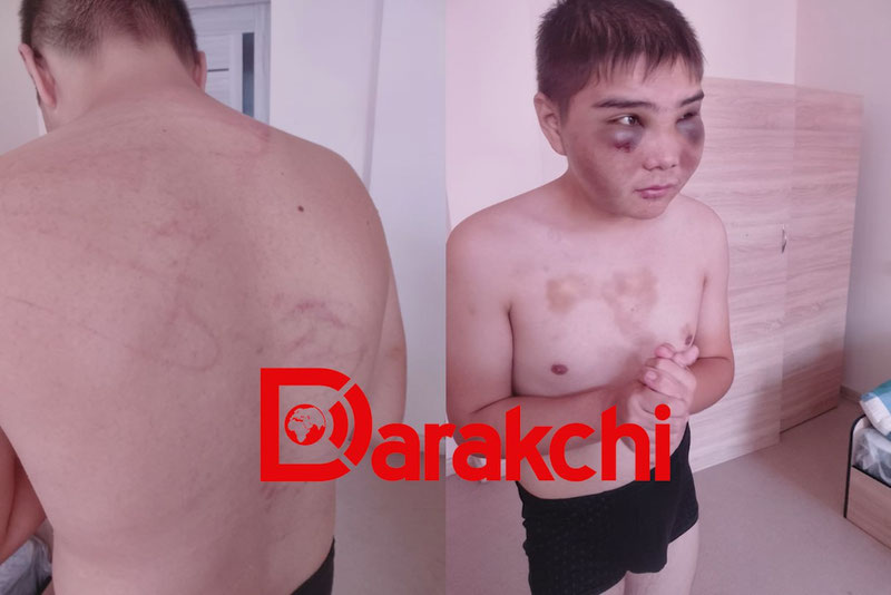 Image of 'In a Tashkent college, a disabled boy was beaten without his wife.'