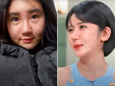 'Ayol 15 yilda 400 ta plastik operatsiya o‘tkazdi'ning rasmi