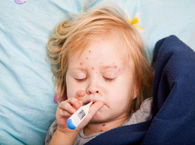 Image of 'For the first time in 27 years, a measles epidemic was recorded in Canada.'