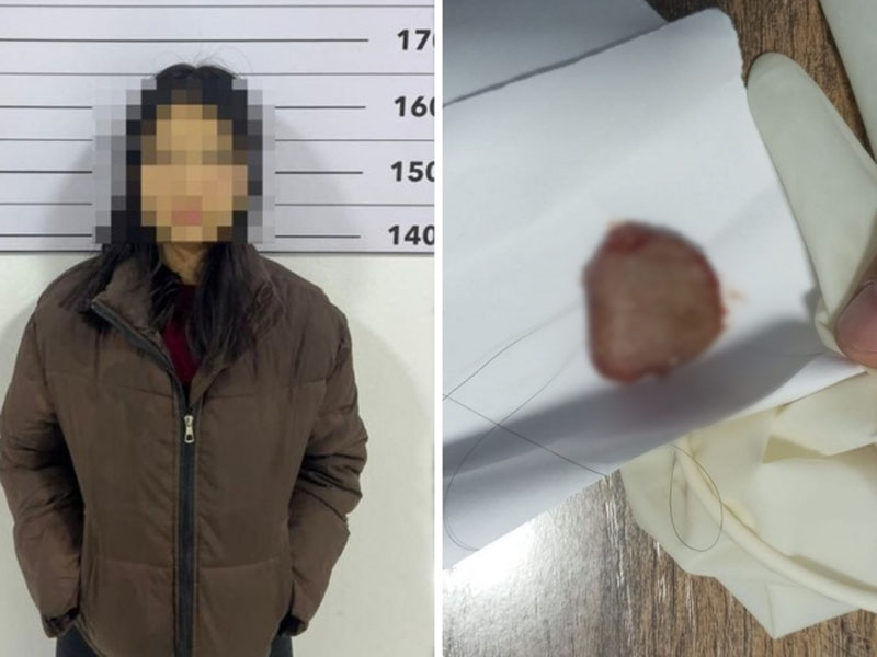 'Қирғизистонда 19 ёшли қиз севгилисининг тилини тишлаб узиб олди'ning rasmi