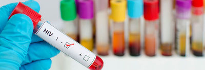 Изрображение 'В Узбекистане число людей, живущих с ВИЧ, превысило 52 тысячи'