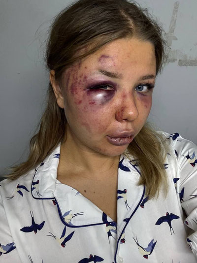 Image of 'A Dagestani MMA fighter is suspected of assaulting a 20-year-old girl.'