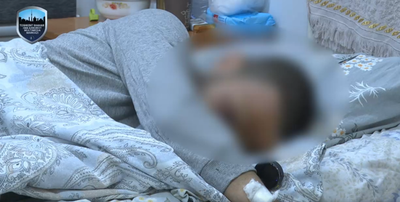 Изрображение 'В Ташкенте подросток потерял кисть руки из-за взрыва пиротехнического изделия'