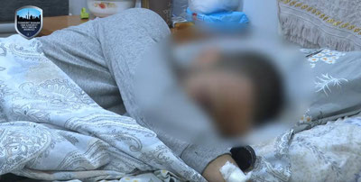 'Тошкентда 24 ёшли йигит пиротехника сабаб кафтидан айрилди'ning rasmi