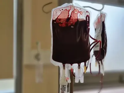 Изрображение 'Как в Узбекистане планируют бороться с дефицитом донорской крови?'