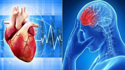 Изрображение 'Национальная программа борьбы с инфарктом и инсультом будет запущена с 1 мая'