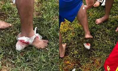 Изрображение 'В Бразилии десять человек пострадали в результате атаки пираний'