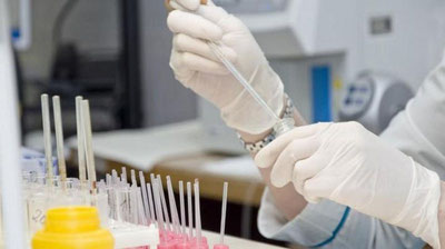 Изрображение 'Ученые назвали два «недооцененных» вируса, способных вызвать новую эпидемию'